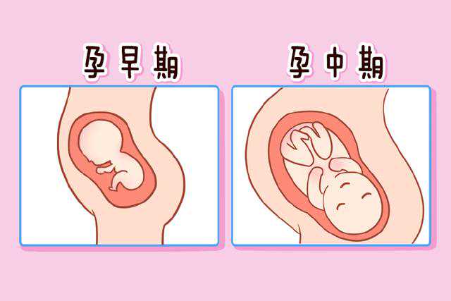蒸桑拿：女性备孕的最佳身体疗养方式！